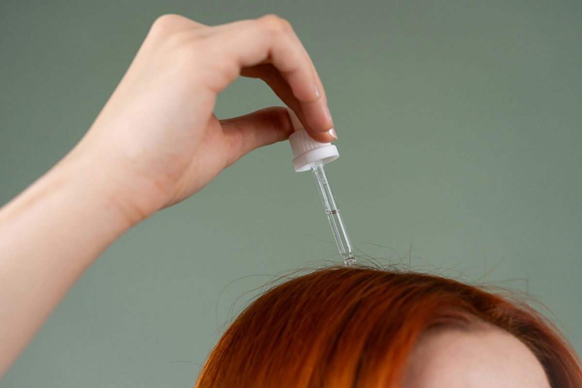 Close‑up of a healthy female scalp and hairline used in a trichologist’s guide to Minoxidil side effects
