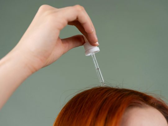 Close‑up of a healthy female scalp and hairline used in a trichologist’s guide to Minoxidil side effects